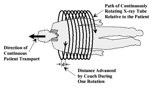 Helical CT Scanning Trajectory