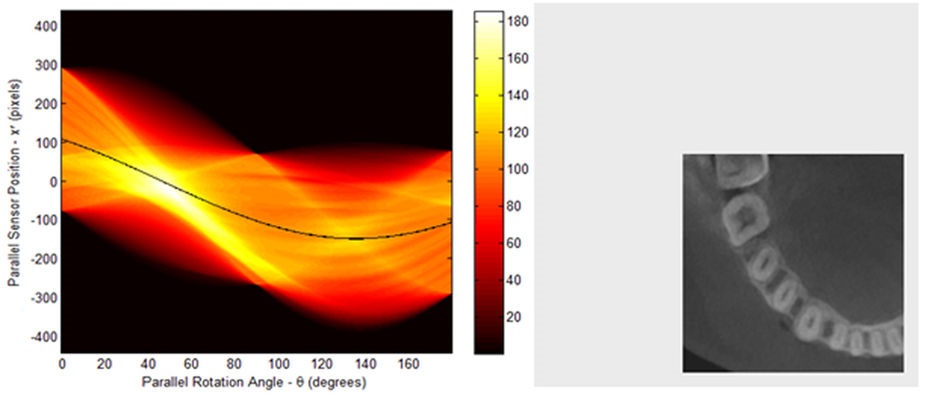 CT正弦图（Sinogram）示例