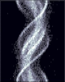 SPECT正弦图数据