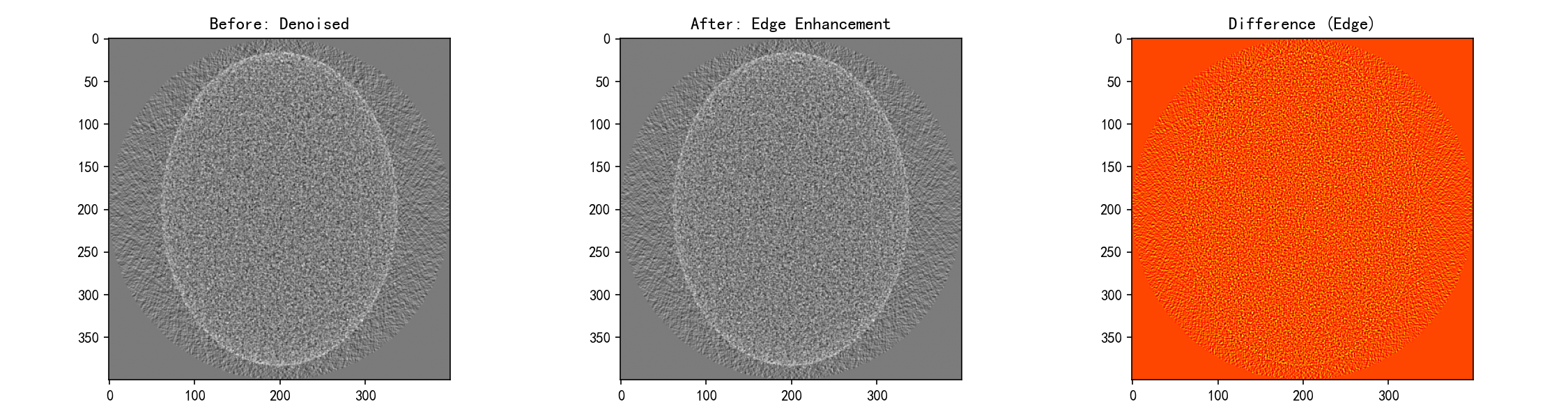 环形伪影校正对比