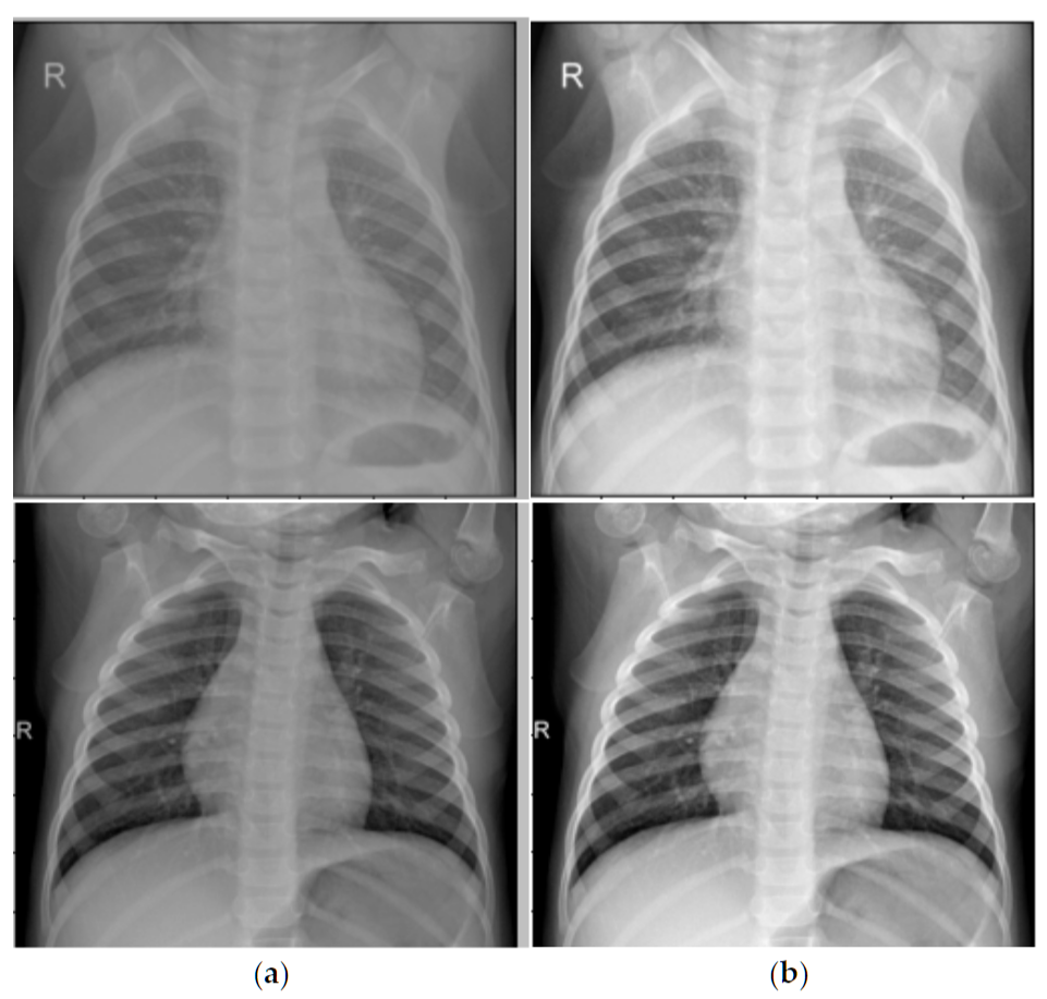 CLAHE Effect Comparison - CLAHE效果对比