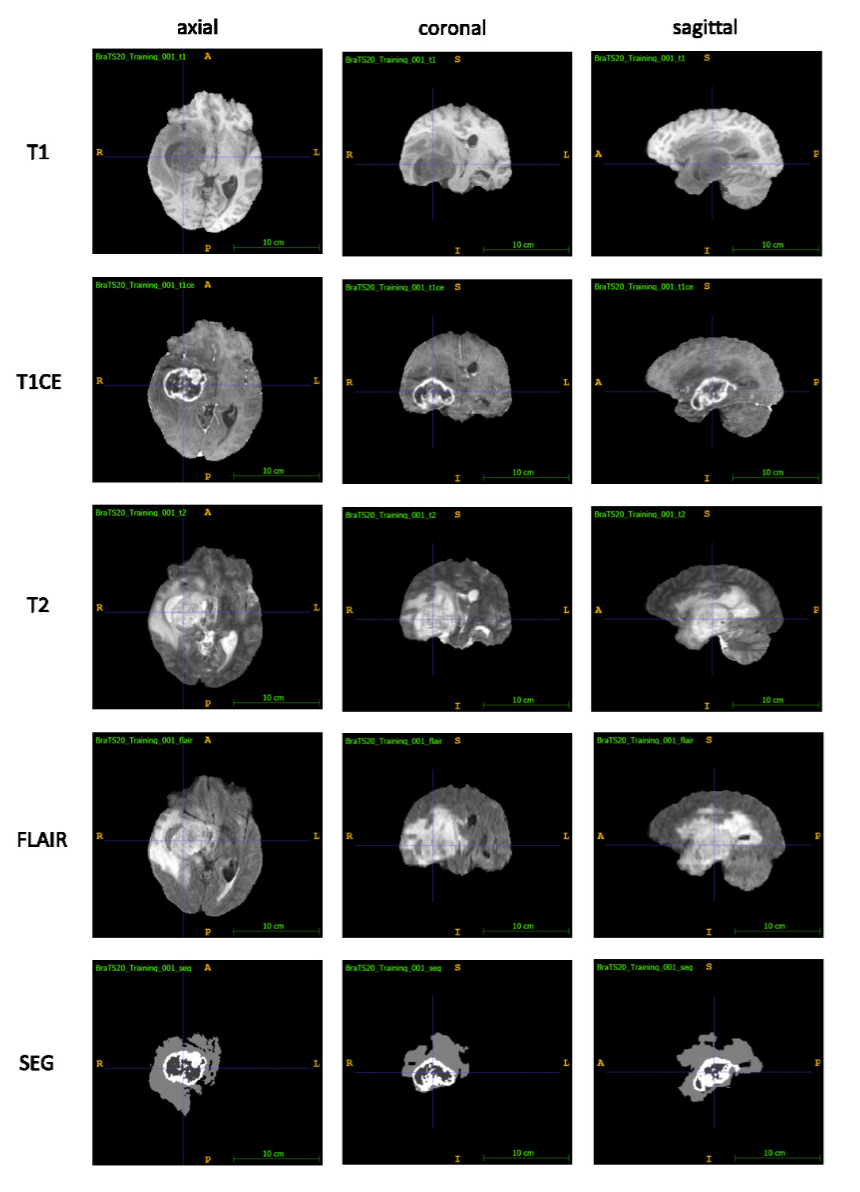 MRI Multi-sequence - MRI多序列对比