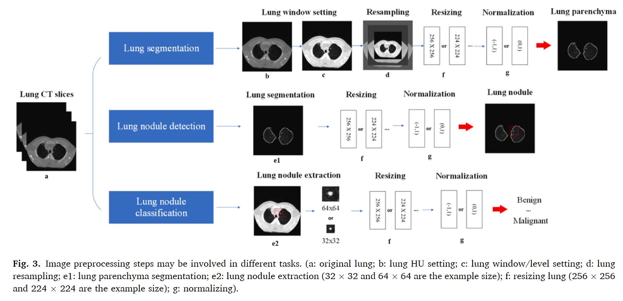 Image preprocessing steps may be involved in different tasks - 不同任务中可能涉及的图像预处理步骤