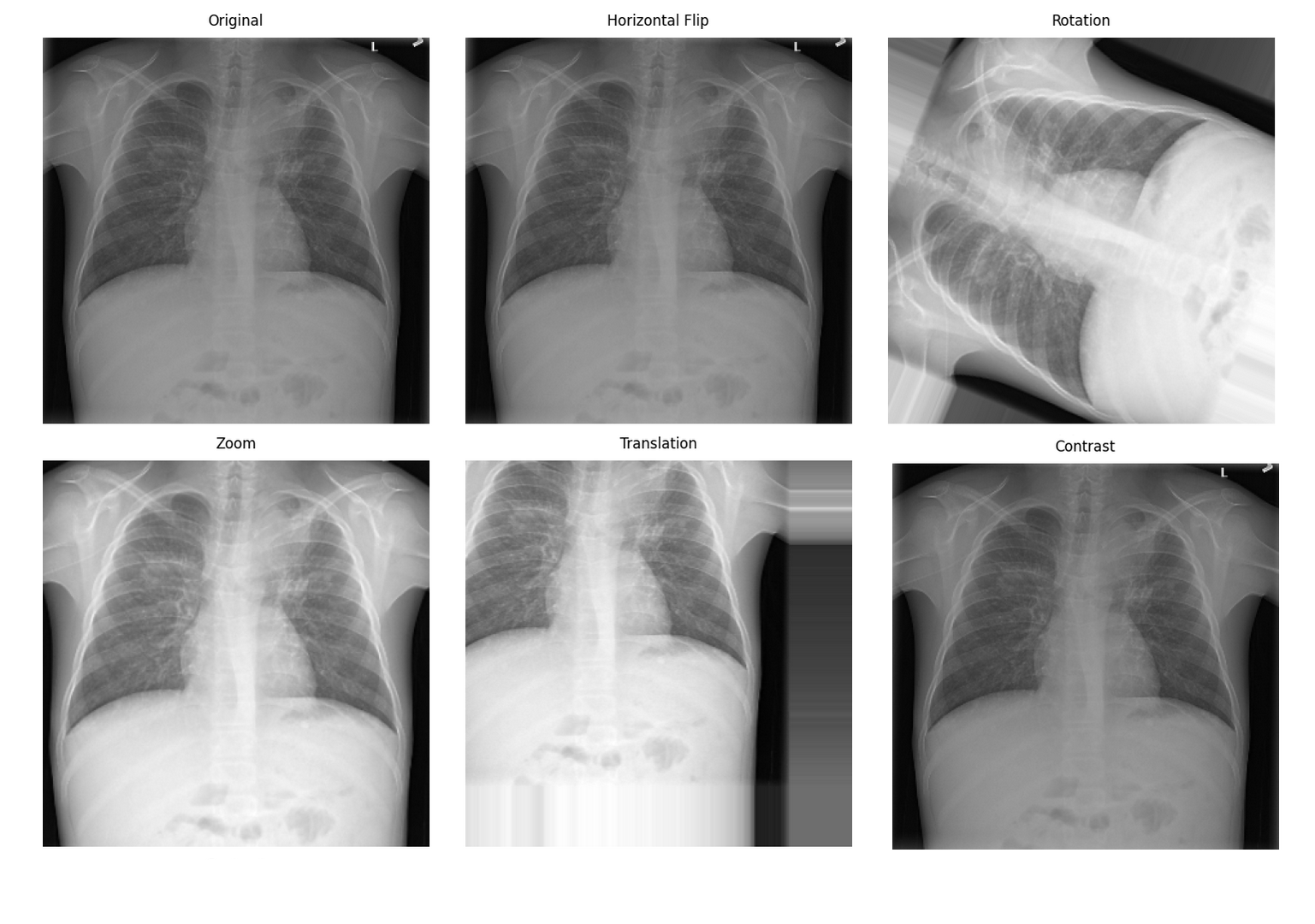 Data Augmentation Effects - 数据增强效果